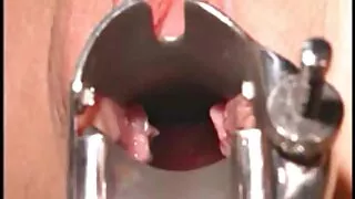 कुखुरा गोरा मा गधा मा ठूलो ओछ्यानमा